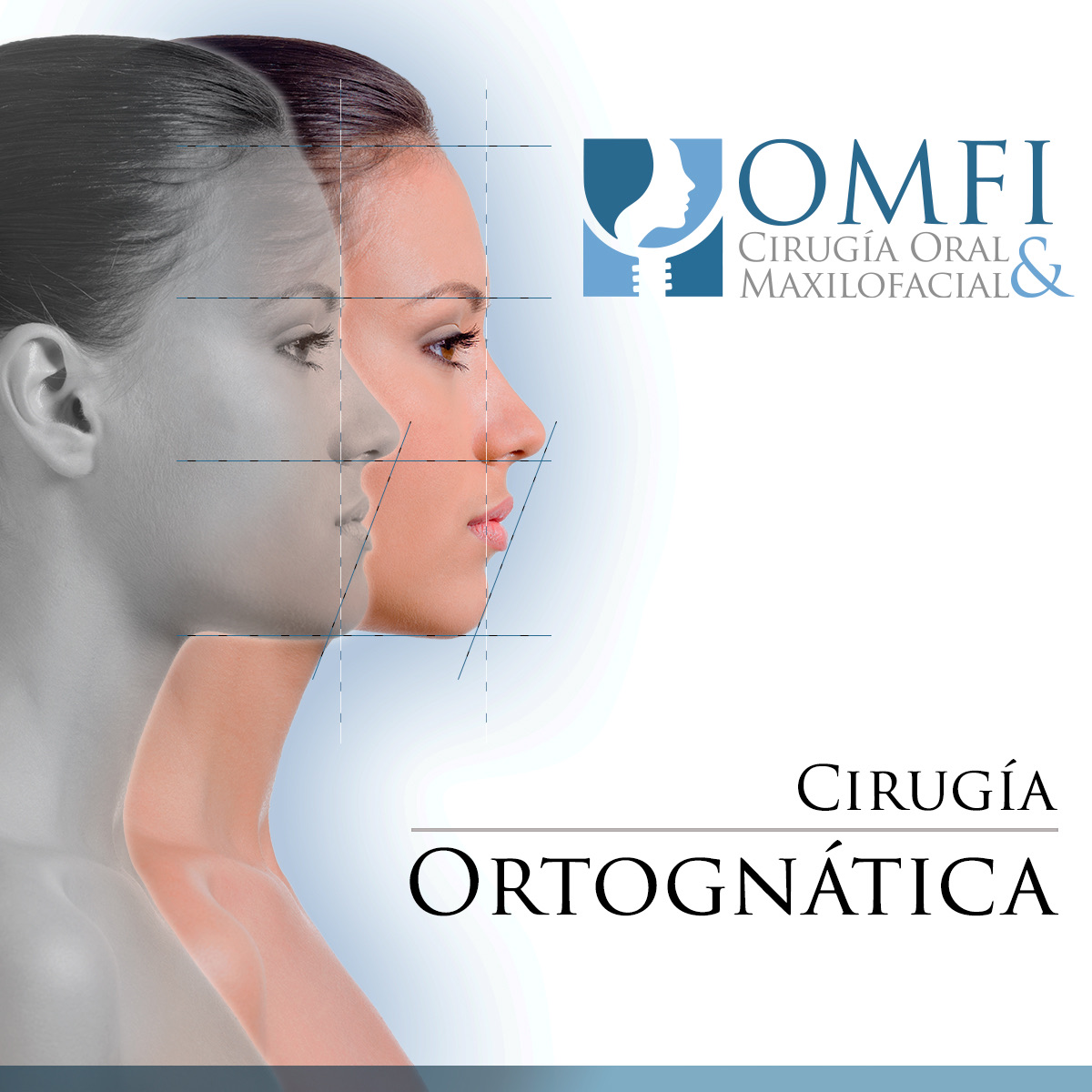 Cirugía Ortognática Durango