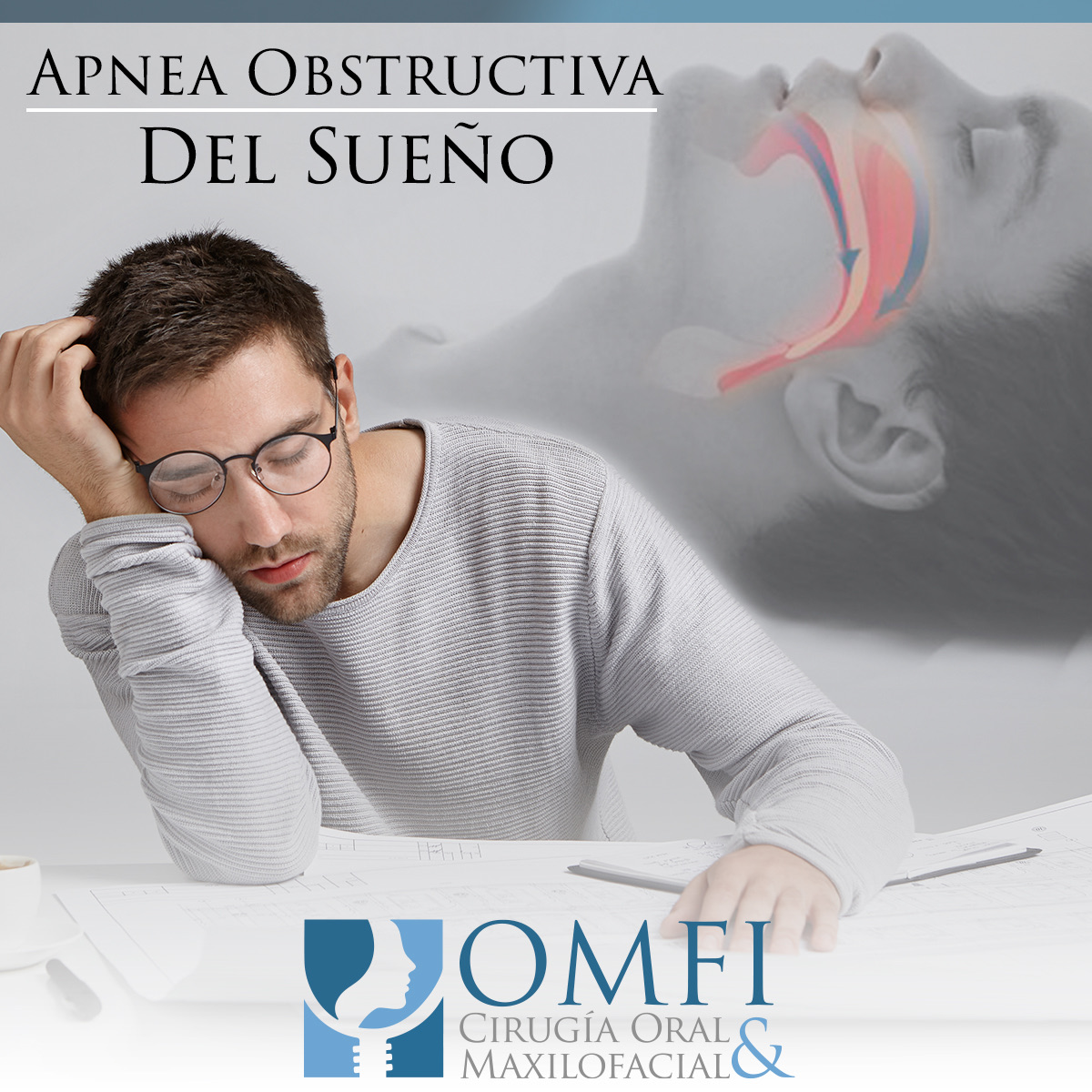 Solución a la apnea obstructiva del sueño
