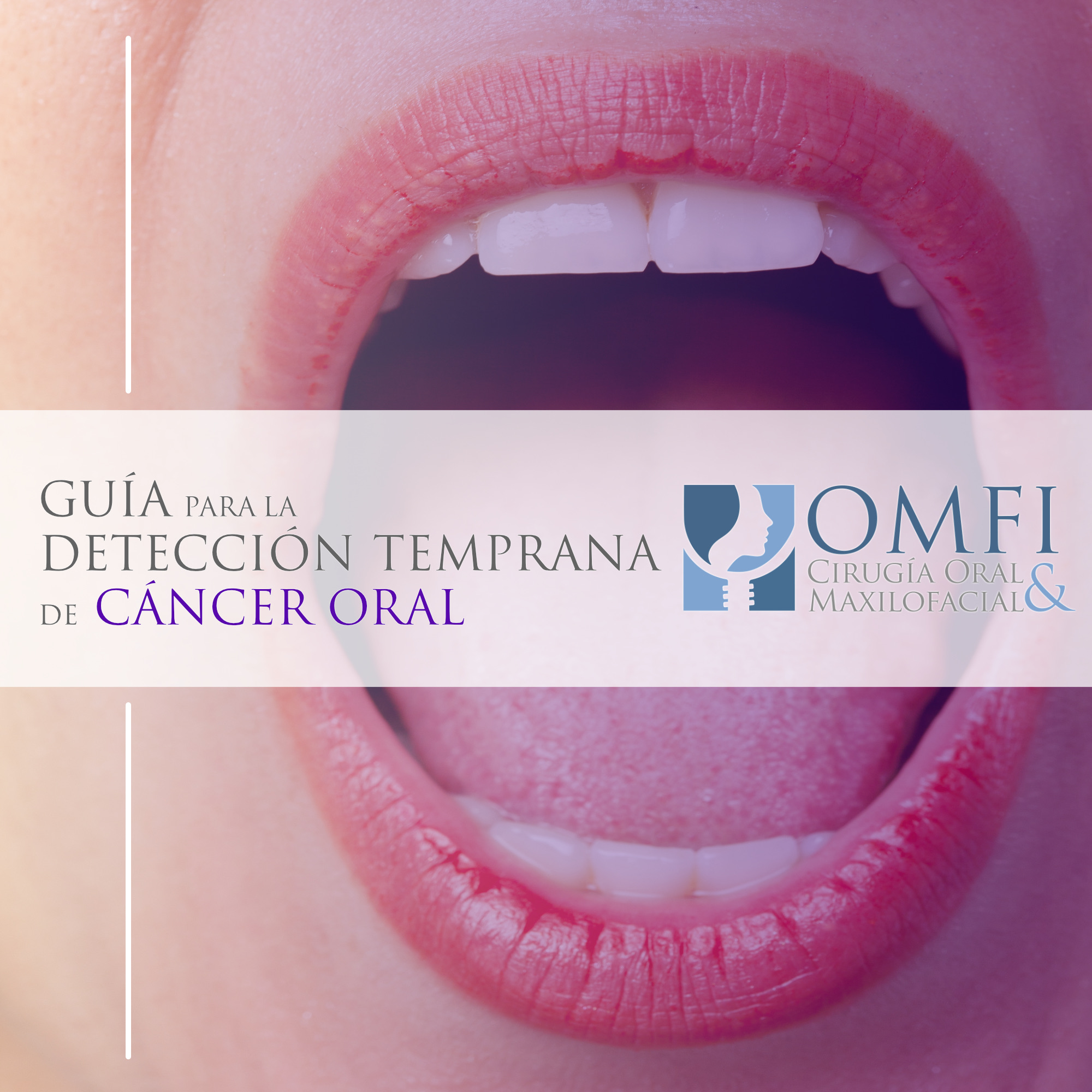 guia para detección de cáncer oral