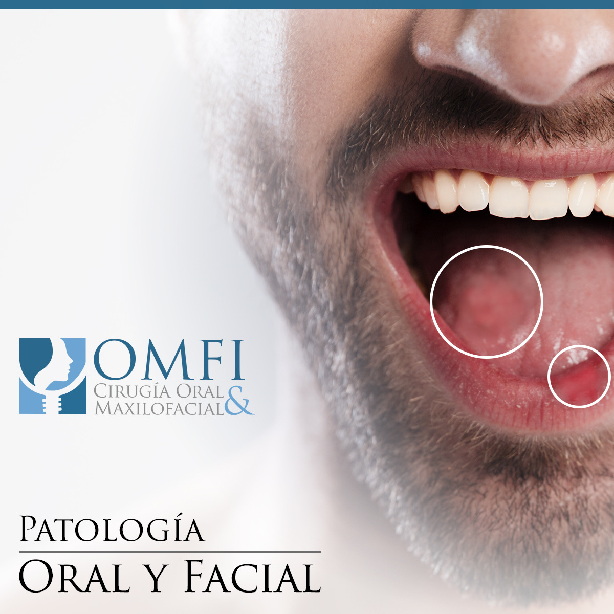 patologia oral detección