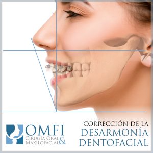 Cirujanos Maxilofaciales de OMFI te ayudarán a corregir tu perfil facial, en Durango.