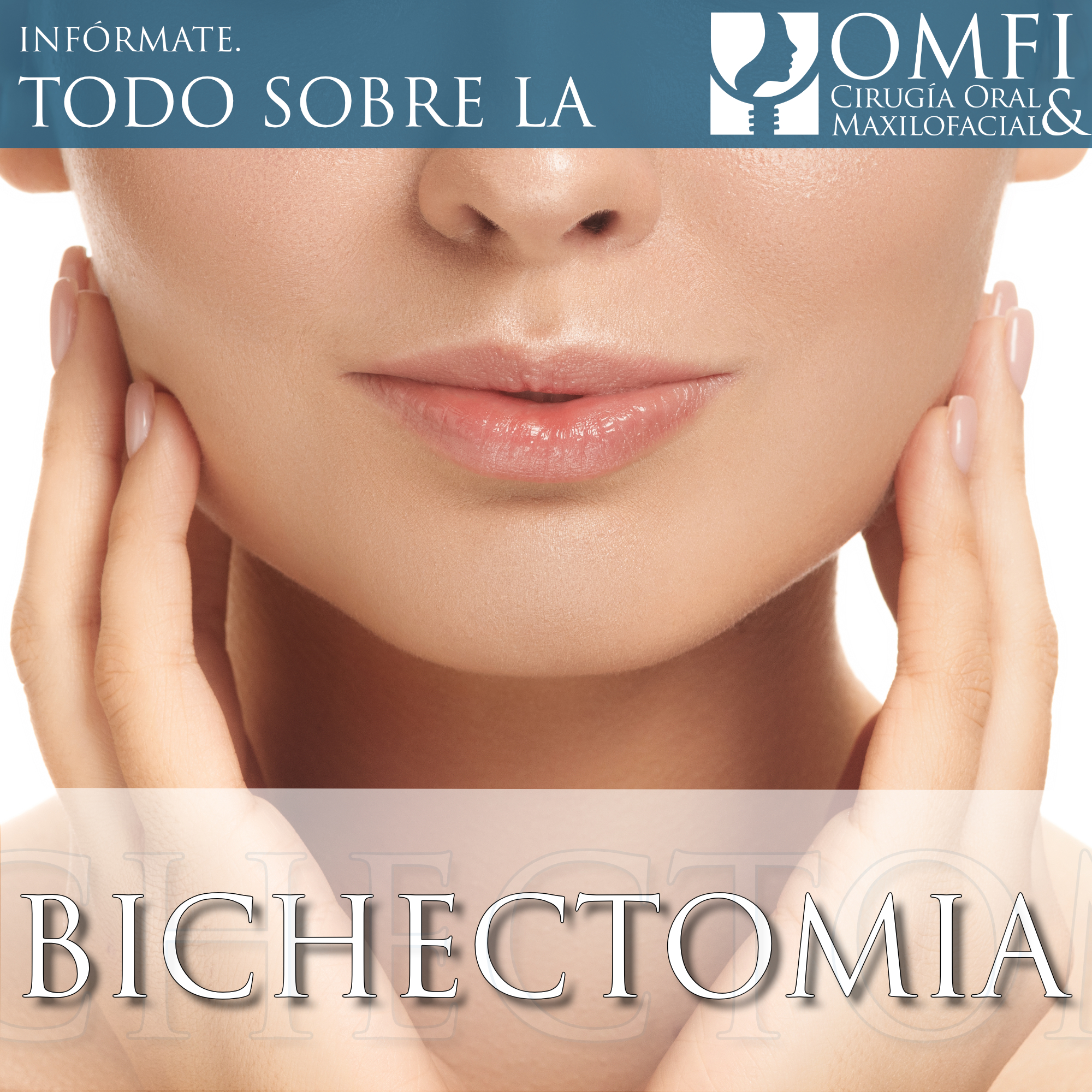 Bichectomía Durango OMFI