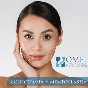 bichectomía y mentoplastía OMFI Durango